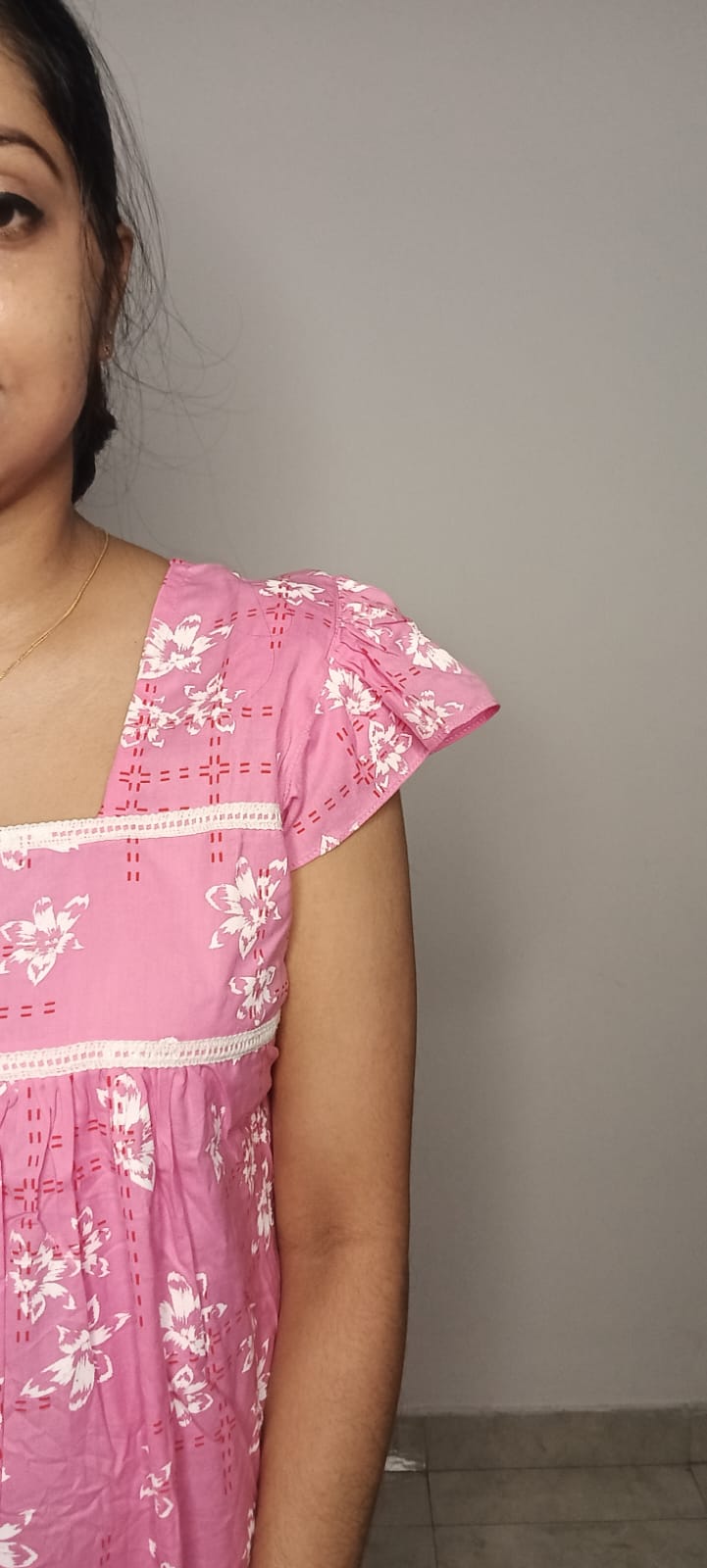 Normal frock